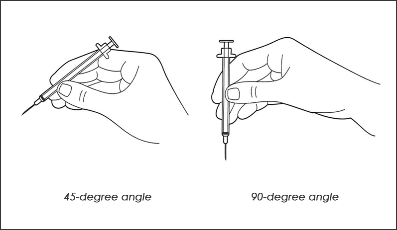 subcutaneous injections can be given at 90 or 45 degree angle