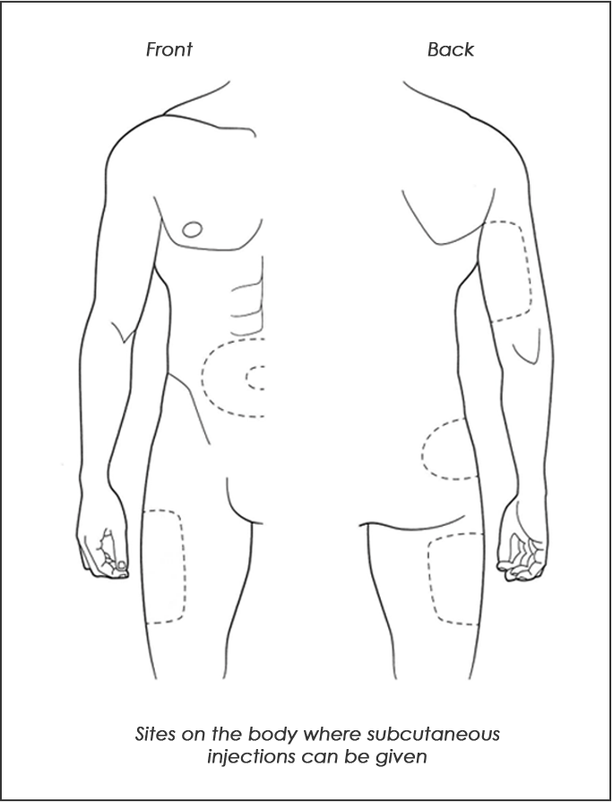 sites on the body where subcutaneous injections can be given