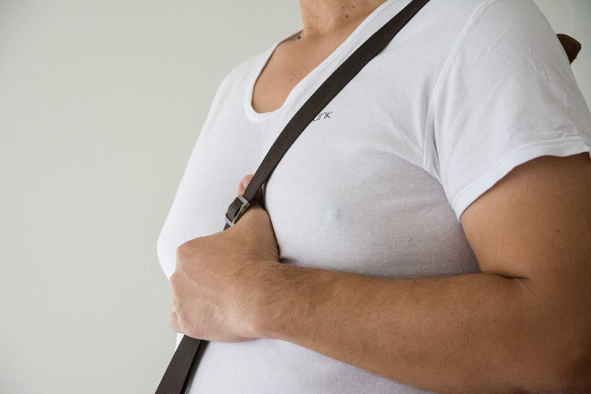 gynecomastia