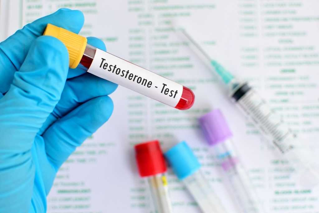 How to get TRT - blood tests