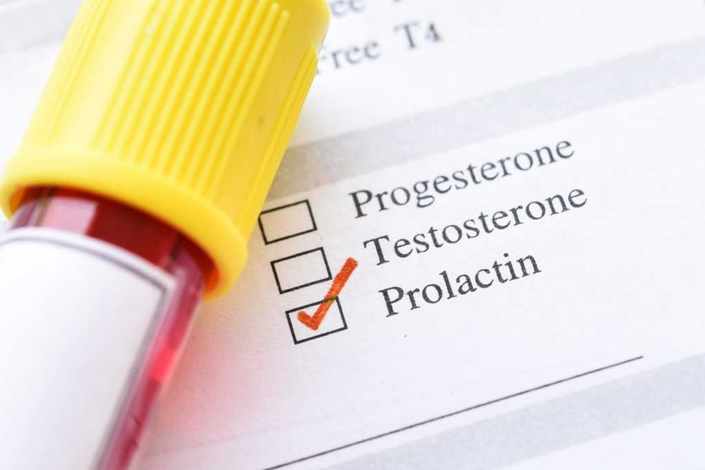 prolactine in male patients