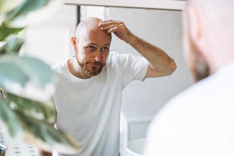 Genetic Predisposition and Hair Loss