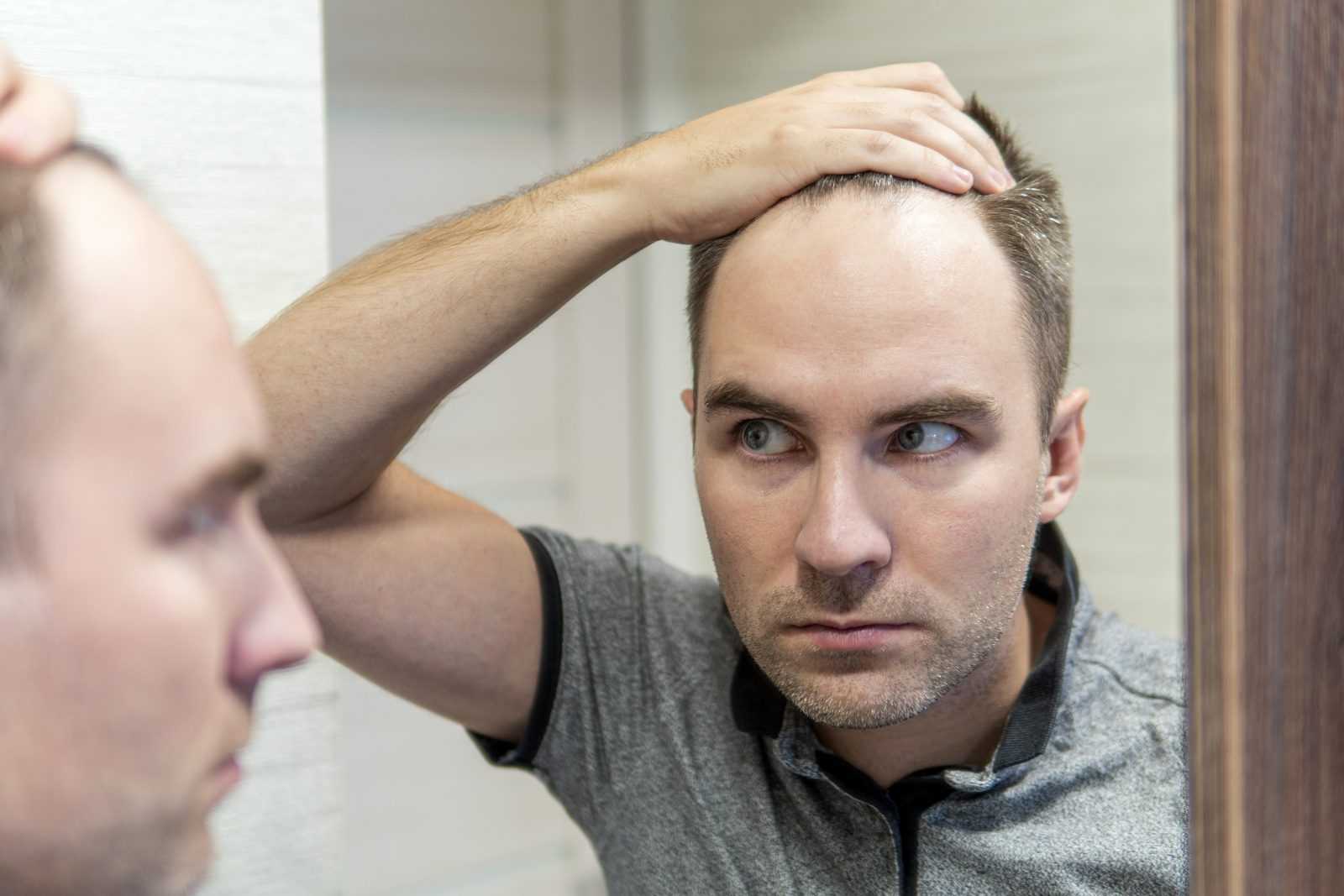 does-testosterone-therapy-cause-hair-loss-exploring-the-facts