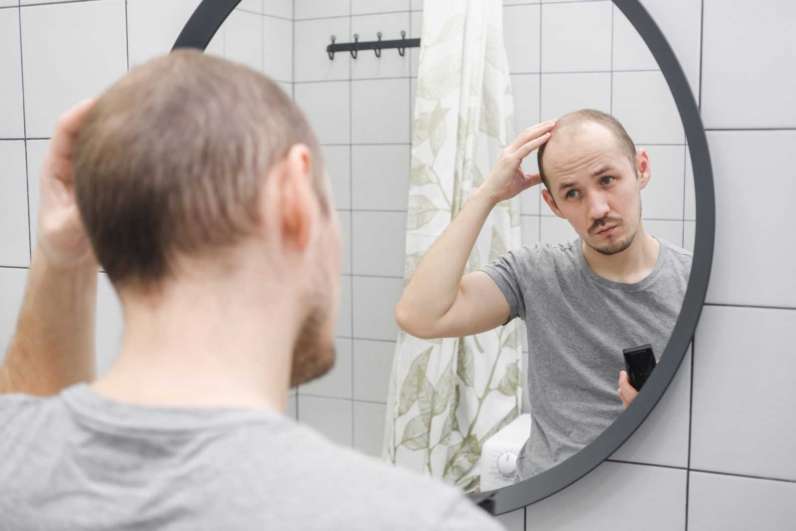 testosterone for hair loss 1