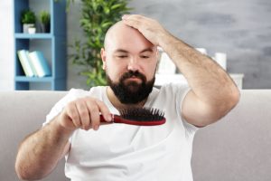 testosterone for hair loss 2