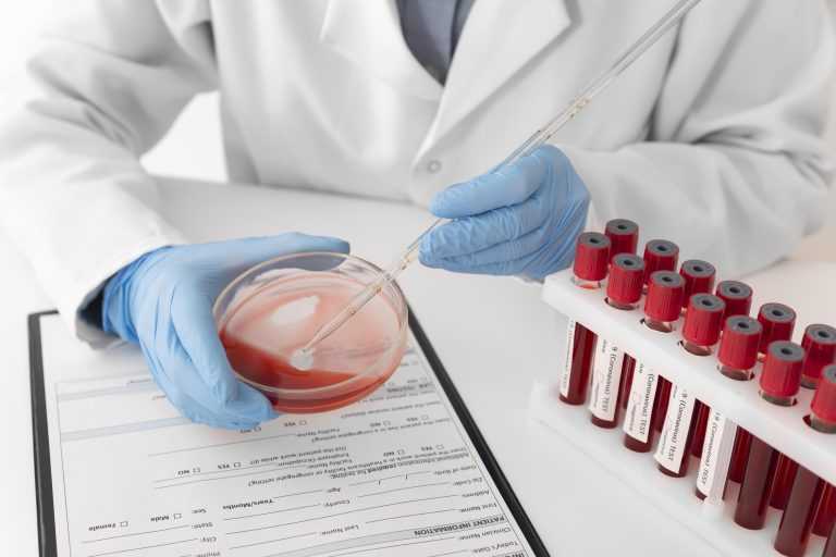 Understanding the Impact of TRT on Red Blood Cell Count: A ...