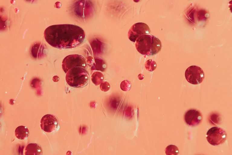 The Link Between TRT And Elevated Red Blood Cells What You Need To Know The link between trt and elevated red blood cells what you need to know