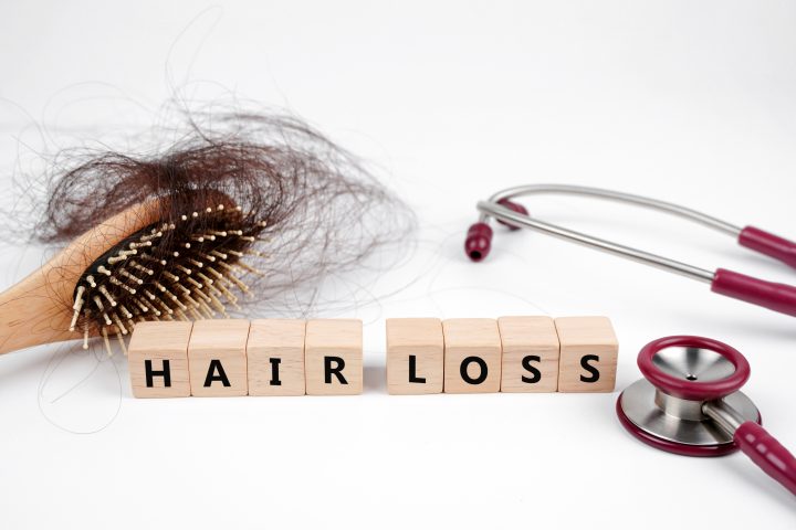 trt and hair loss 1