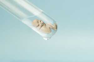 clomid and letrozole 4