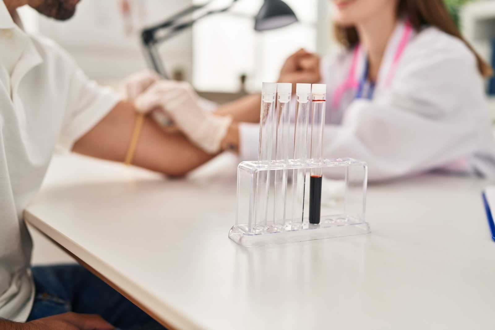 testosterone therapy labs 1