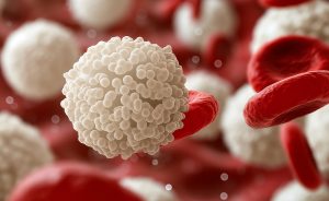 low t lymphocytes 3