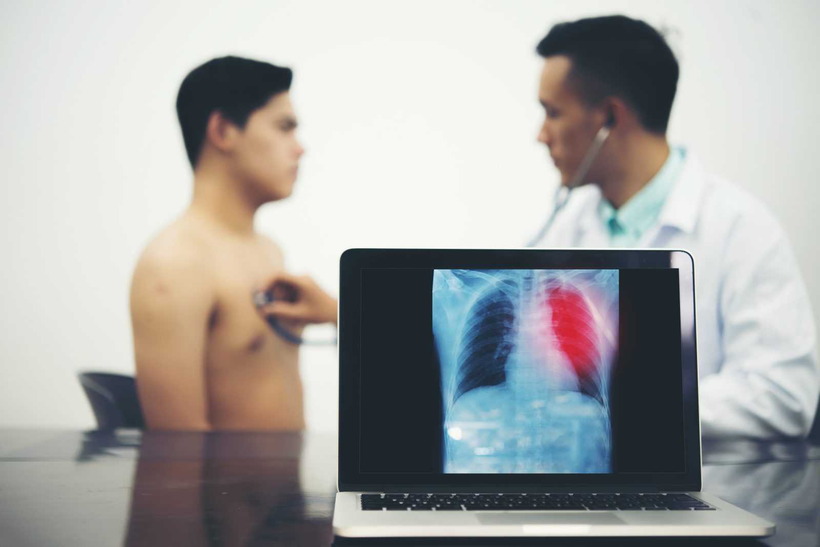 testosterone therapy and pulmonary embolism 1