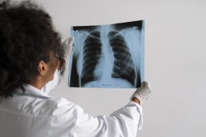 testosterone therapy and pulmonary embolism 2