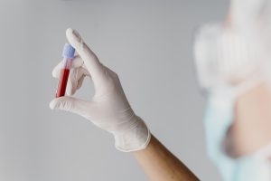 trt and hematocrit 2