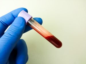trt and hematocrit 4