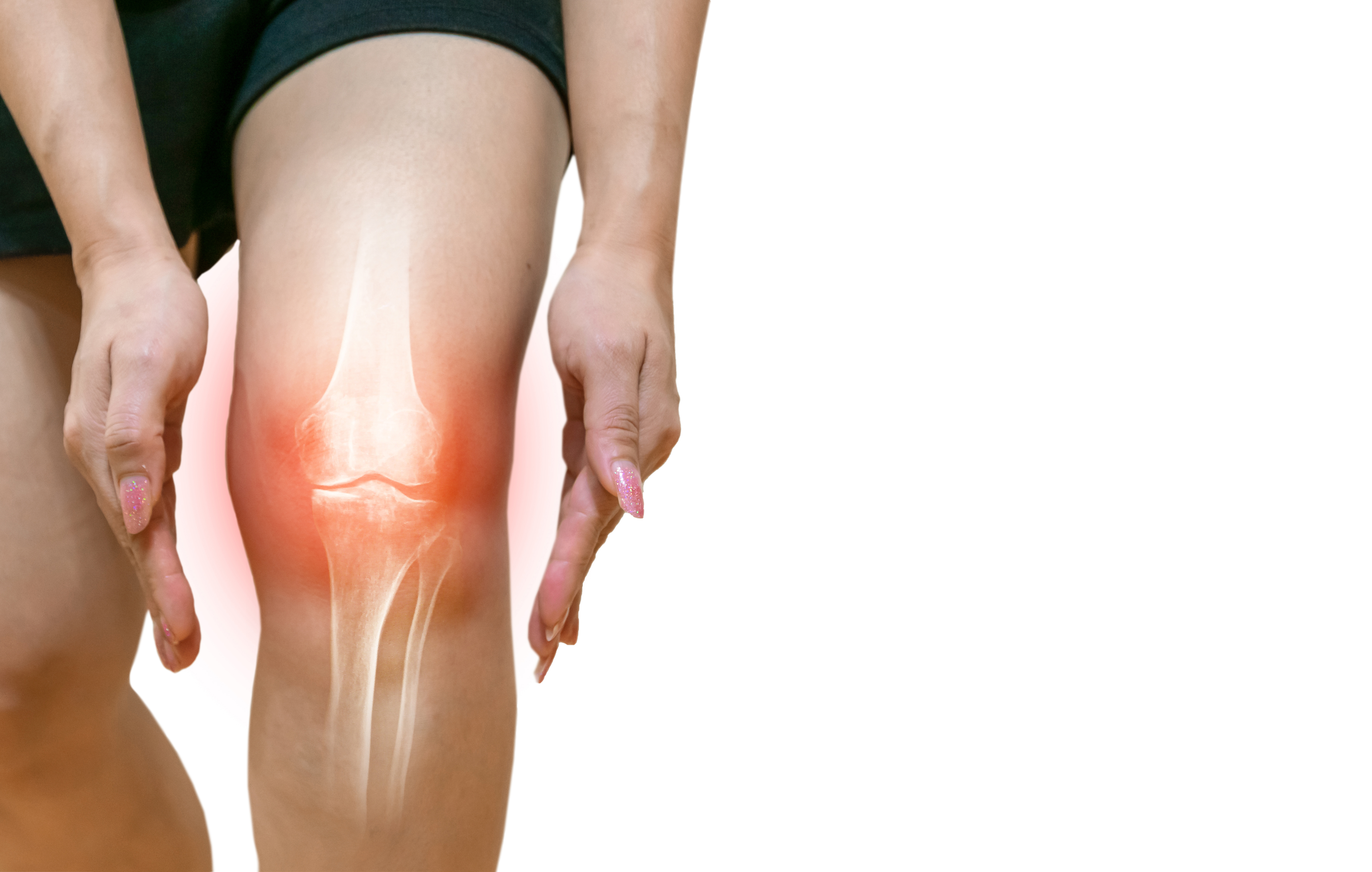 trt and osteoarthritis 1