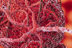 trt and polycythemia 2