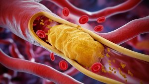 testosterone therapy and cholesterol 2