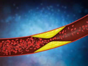 testosterone therapy and cholesterol 4