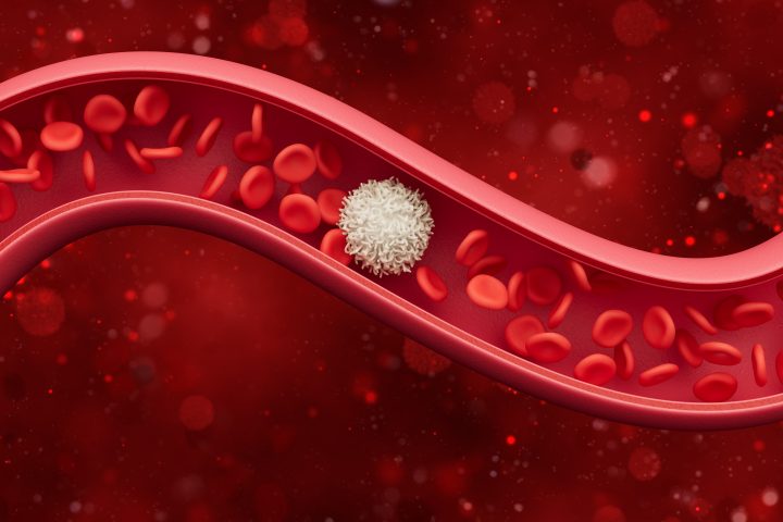 testosterone therapy blood clots 1