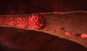 testosterone therapy blood clots 2