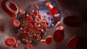 testosterone therapy blood clots 4