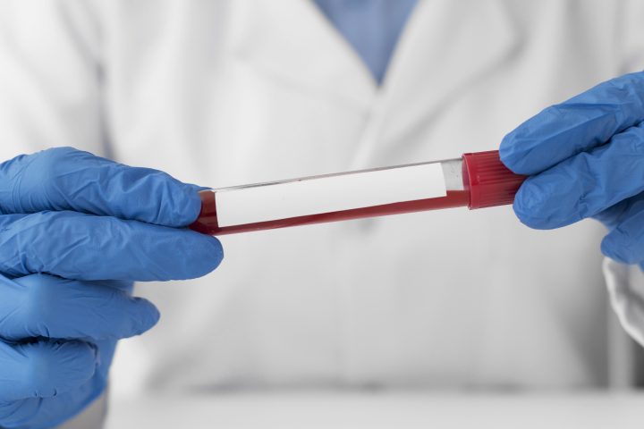 can testosterone therapy cause polycythemia 1