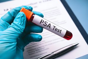 can testosterone therapy increase psa 2