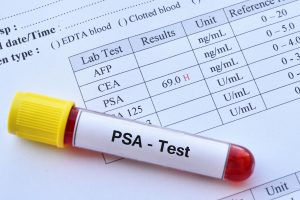 can testosterone therapy increase psa 3