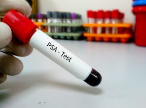 can testosterone therapy increase psa 4